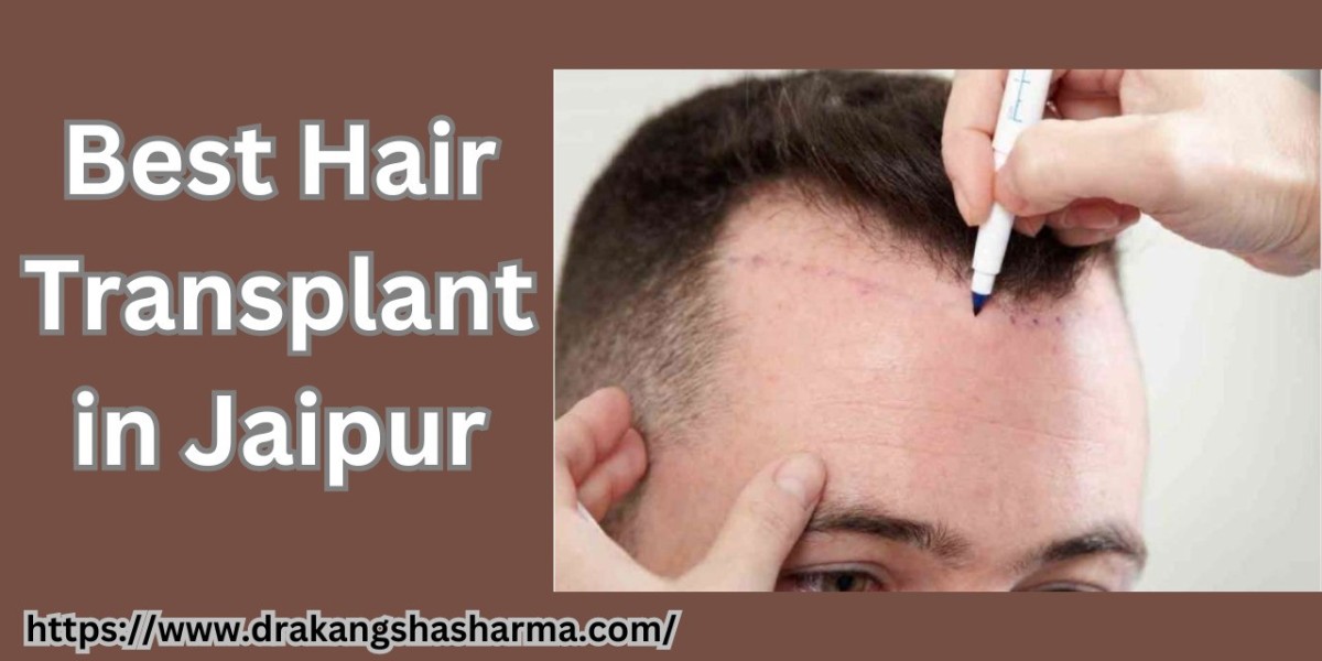 Hair Shedding After a Hair Transplant: A Detailed Guide